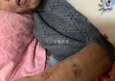 上海一老人在养老院疑遭捆绑，四肢多处伤口！警方已立案